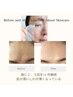 【ハリ艶実感☆】高濃度炭酸パック/デコルテパック＆ドライヘッドスパ￥3000