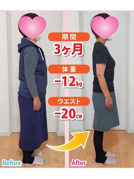 シエラボーテ/20年前のサイズに戻りました！