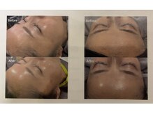 ケンジョビューティーサロン(Kenjo  Beauty Salon)の雰囲気（ララピ－ル　ビフォーアフター）