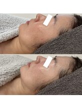 ヴェルシック(Belchic)/くすみ、むくみのない若々しい肌