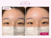 キミア(KIMIA)/バインドロック