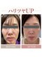 カエラ(KAELA)の写真/たるみがちなお肌の引き締め/たるみ毛穴のケア/ツヤ肌/弾力があり瑞々しい肌に