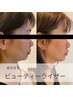 【顔のたるみ/面長/二重アゴ/瞼に◎】深層から整うリフトアップ術/初回¥5,980