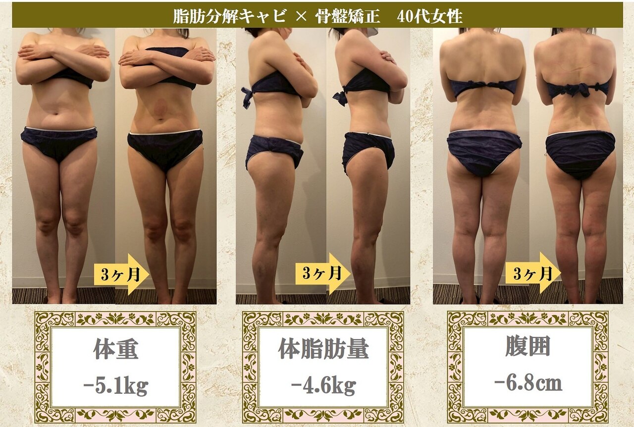 ラジオ波 キャビテーション 体験に関するサロン Beauty salon Lino