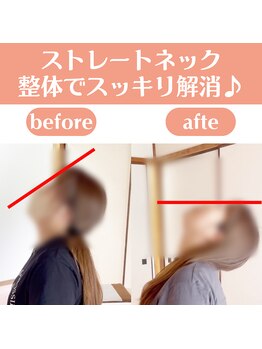 整体天使のはね 福山店/ストレートネックの肩こりも◎