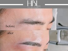 アポロ(Apollo)/ハリウッドブロウリフト