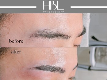 アポロ(Apollo)/ハリウッドブロウリフト