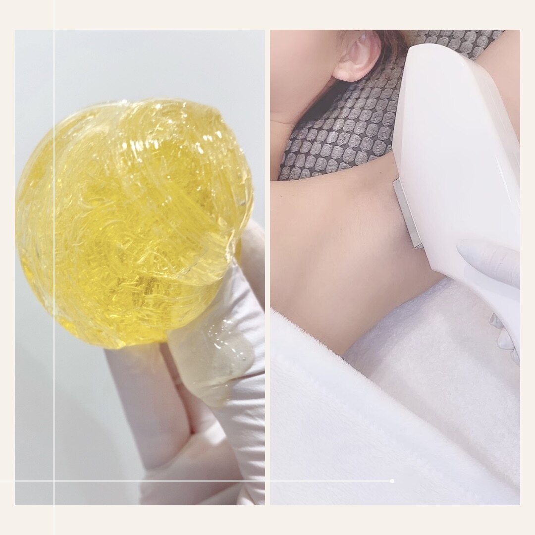 【初回/女性】人気NO１！VIOシュガーリング脱毛+最新美容脱毛SET 45分 \8980