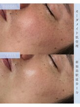 ヴィノ フクシマ(VINO fukushima)/肌ケア《SEN管理》