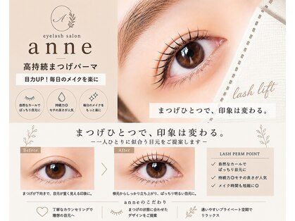 アン(anne)の写真