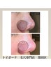 【ホットペッパー限定★いちご鼻撃退】毛穴洗浄＋鎮静パックの簡易コース