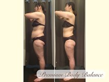 美プレミアム 川越店/施術結果