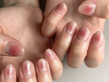 オンシジューム(Oncidium)/チークネイル(^^)