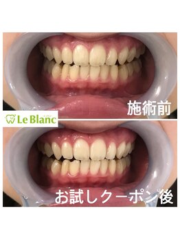 ルブラン 奈良店(Le Blanc)/フリーパスstart!!