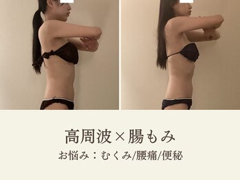 ミオン(美温)/そり腰ぎみの方や猫背の方にも!