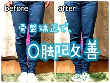ヴェール 青山(vert)/骨盤矯正ビフォーアフター