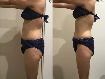 キララ(Kirara)/一回でこの変化★