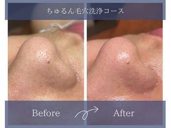 サロンドボーテアリス (Salon de beaute ALICE)/至近距離もこれで怖くない♪