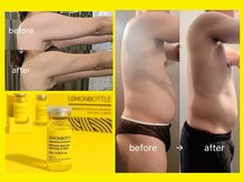 【レモンボトルは各部位にもアプローチできます！：全身デザイン♪】