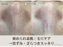 レガロビューティクリエイションズ桜川店/褒められ素肌│毛穴ケア