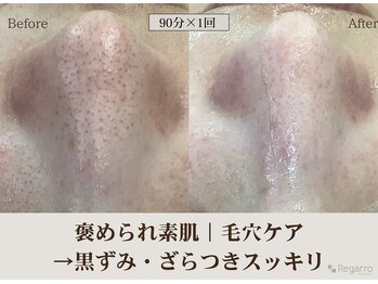 レガロビューティクリエイションズ桜川店/褒められ素肌│毛穴ケア