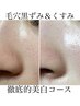期間限定!【毛穴&白玉】黒ずみ&くすみ徹底美白コース 90分