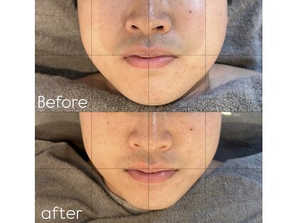 メンズエムボーテ 太田店(Men's M BEAUTE33)の写真
