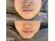 メンズエムボーテ 太田店(Men's M BEAUTE33)の写真