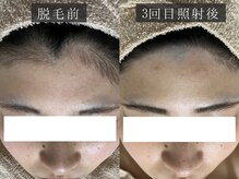 ベルフィーヌ 恵比寿店(BELFINE)/お悩みに合わせてお施術します