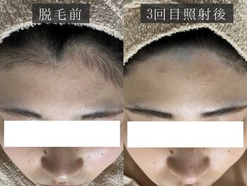 ベルフィーヌ 恵比寿店(BELFINE)/お悩みに合わせてお施術します