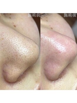 アンク(Ankh)/自宅でできる簡単ケアも大好評★