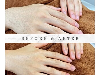 ゼロ アンド リセット(0ZERO&RESET)/【メンズ脱毛】0ZERO&RESET