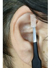 鍼灸院凪/カリム(Calme)/よくあるご質問