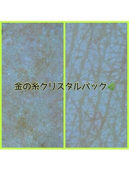 アブソリュートワン(absolute1)/塗る金の糸クリスタルパック
