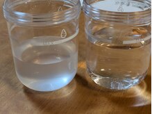 リノリー 一関店(rinory)/毛穴洗浄