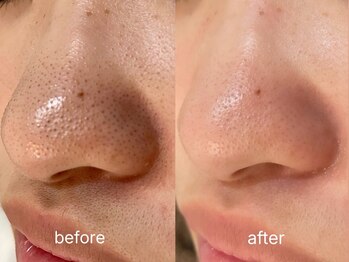 フェリーチェ(FELICE)