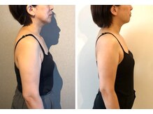 ミチカケ トリムリターン那覇市店/姿勢が変わるとお顔も変化！