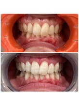 エクシアホワイトニング 日本橋店/セルフホワイトニング