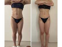 デュモンド(dumonde)/30代OO様の変化