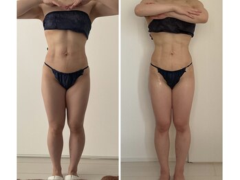 デュモンド(dumonde)/30代OO様の変化