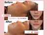【20代人気No.1】垢抜け小顔矯正×毛穴洗浄◆写真映えするシャープな横顔45分