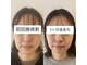 リアプア(Li'a)の写真/『小顔になりたい方』　たるみから整える小顔ケア│変化実感で叶えるリフトアップ小顔　小顔矯正/たるみ