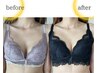 【流れた脂肪も、もっちりバストへ】バストケア|50分