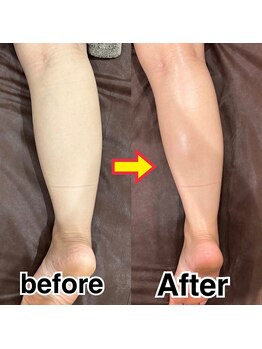 ディオーネ(Dione)/低価格☆技術も施術も最高!