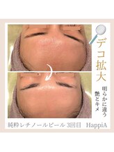 ハピア(HappiA)/純粋レチノールピール