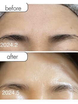 サロンドシー(SALON de C.)/毛穴・くすみ改善