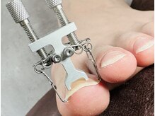 ツメハピ(tumehapi)/ケア後にやさしく牽引機♪