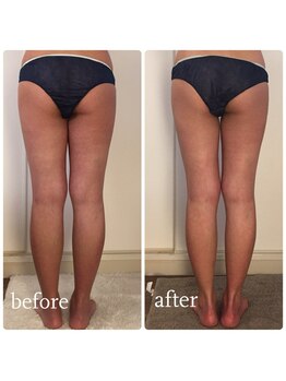 加圧ビューティーサロン スタイル エム(beauty salon style M)/20代/痩身リンパ120分のみ