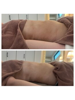 美温(mion)/胃腸が弱く冷え冷えガチガチ