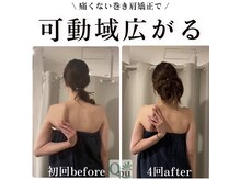キュープ 福岡天神店(Qpu)の雰囲気（姿勢改善・巻き肩矯正もございます。）